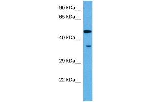 Host:  Rabbit  Target Name:  MEF2A  Sample Tissue:  Rat Skeletal Muscle  Antibody Dilution:  1ug/ml (MEF2A anticorps  (N-Term))