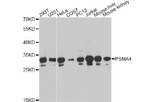 Western blot analysis of extracts of various cell lines, using PSMA4 antibody (ABIN6291447) at 1:1000 dilution. (PSMA4 anticorps)
