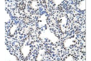 anti-serine/arginine-Rich Splicing Factor 10 (SRSF10) (C-Term) antibody