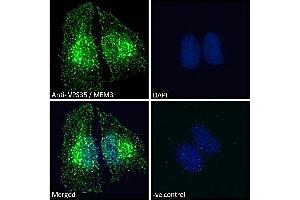 (ABIN185182) Immunofluorescence analysis of paraformaldehyde fixed HEK293 cells, permeabilized with 0.