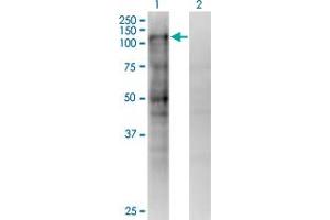 Western Blot analysis of MSH2 expression in transfected 293T cell line by MSH2 monoclonal antibody (M02), clone 4B2.