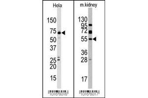 Western blot analysis of anti-JMJD4 (C-term) Pab in Hela and mouse kidney cell line lysate. (JMJD4 anticorps  (C-Term))