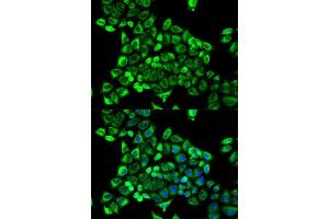 Immunofluorescence analysis of MCF-7 cells using CDA antibody. (CDA anticorps  (AA 1-146))