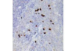 Immunohistochemistry of paraffin-embedded rat spleen using S100 Rabbit pAb (842) at dilution of 1:100 (40x lens).