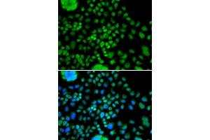 Immunofluorescence analysis of MCF-7 cells using ATOH7 antibody. (ATOH7 anticorps)
