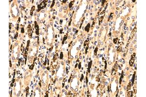 ABIN6261736 and ABIN6266540 at 1/100 staining Rat kidney tissue by IHC-P. (FGFR3 anticorps  (C-Term))
