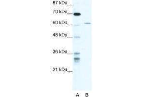 WB Suggested Anti-ZNFN1A4 Antibody Titration: 1. (IKZF4 anticorps  (N-Term))
