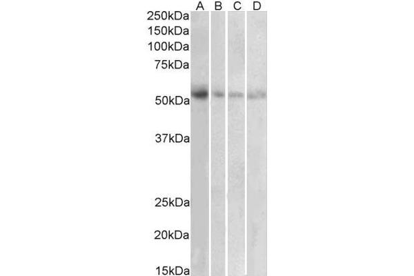 SLC18A2 anticorps  (C-Term)