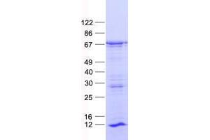 Validation with Western Blot