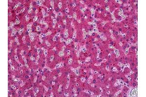 Anti-ITIH4 antibody IHC of human liver. (ITIH4 anticorps  (AA 744-758))