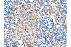 Image no. 1 for anti-Heat Shock 27kDa Protein 1 (HSPB1) (C-Term) antibody (ABIN203358)