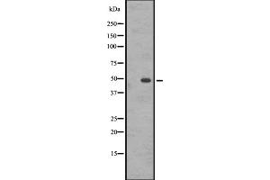Western blot analysis of GASR expression in A431 whole cell lysate ,The lane on the left is treated with the antigen-specific peptide. (CCKBR anticorps  (N-Term))