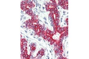 Immunhistochemistry analysis in human breast tissue (Formalin-fixed, Paraffin-embedded) using Peroxin 7 / PEX7 