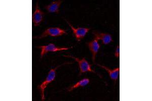 Immunofluorescence analysis of ERAS polyclonal antibody  in HeLa cells. (ERAS anticorps  (N-Term))