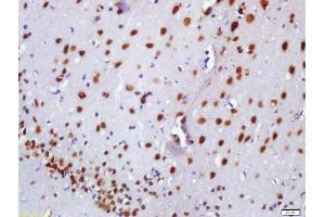 Formalin-fixed and paraffin embedded rat brain labeled with Anti-BASP1 Polyclonal Antibody, Unconjugated  at 1:200 followed by conjugation to the secondary antibody and DAB staining (BASP1 anticorps  (AA 3-100))