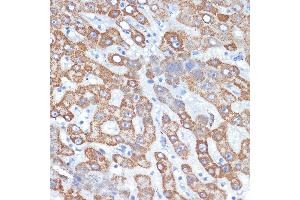 Immunohistochemistry of paraffin-embedded human liver using HMGCS2 Rabbit mAb (ABIN7265328) at dilution of 1:100 (40x lens). (HMGCS2 anticorps)