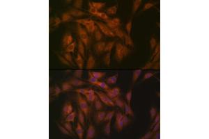 Immunofluorescence analysis of C6 cells using eIF3B Rabbit mAb (ABIN7267042) at dilution of 1:100 (40x lens).