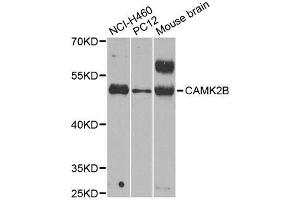 Western blot analysis of extracts of various cell lines, using CAMK2B antibody. (CAMK2B anticorps  (AA 1-300))