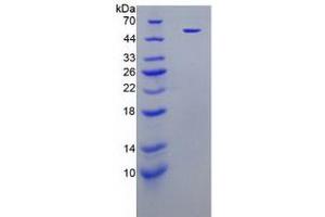 SDS-PAGE analysis of Human Neutrophil Elastase Protein (Recombinant). (ELANE Protéine)
