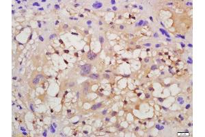 Formalin-fixed and paraffin embedded mouse placenta tissue labeled with Anti-VEGFR2 Polyclonal Antibody, Unconjugated  at 1:200 followed by conjugation to the secondary antibody and DAB staining.
