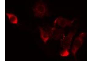 ABIN6274424 staining Hela by IF/ICC.