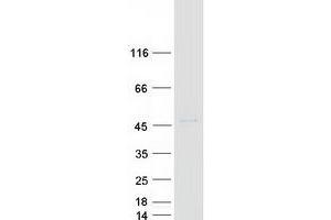 Validation with Western Blot