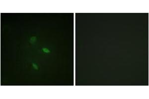 Immunofluorescence analysis of NIH-3T3 cells, using Cyclin E2 (Ab-392) Antibody. (Cyclin E2 anticorps  (AA 355-404))