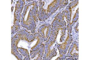 IHC analysis of TFEB using anti-TFEB antibody (ABIN7600648).