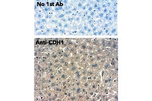 Immunohistochemistry (IHC) image for anti-Cadherin 1, Type 1, E-Cadherin (Epithelial) (CDH1) antibody (ABIN1440031)