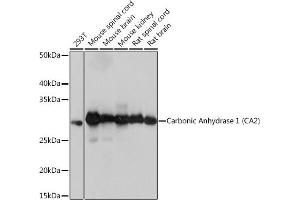 Western blot analysis of extracts of various cell lines, using Carbonic Anhydrase 2 (C) Rabbit mAb (ABIN7266070) at 1:1000 dilution. (CA2 anticorps)