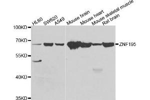 Western blot analysis of extracts of various cell lines, using ZNF195 antibody. (ZNF195 anticorps)