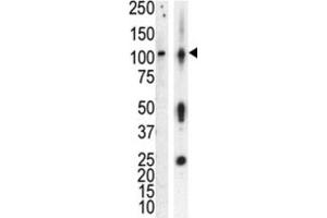 Western Blotting (WB) image for anti-Protein Kinase D3 (PRKD3) antibody (ABIN3002937) (PRKD3 anticorps)