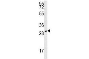 TPSAB1 antibody western blot analysis in 293 lysate. (TPSAB1 anticorps  (AA 61-87))