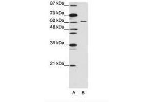 Image no. 2 for anti-CUGBP, Elav-Like Family Member 2 (CELF2) (AA 73-122) antibody (ABIN203186) (CELF2 anticorps  (AA 73-122))