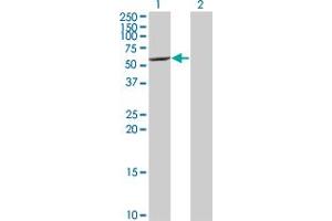 Western Blot analysis of CYP7B1 expression in transfected 293T cell line by CYP7B1 monoclonal antibody (M06), clone 2B11.