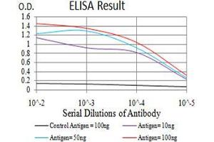 Black line: Control Antigen (100 ng), Purple line: Antigen(10 ng), Blue line: Antigen (50 ng), Red line: Antigen (100 ng),