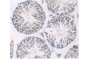Detection of C1INH in Mouse Testis Tissue using Polyclonal Antibody to Complement 1 Inhibitor (C1INH)