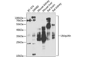 Western blot analysis of extracts of various cell lines, using Ubiquitin antibody (ABIN3022990, ABIN3022991, ABIN3022992 and ABIN6219334) at 1:1000 dilution. (Ubiquitin B anticorps  (AA 1-76))