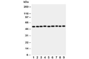 Western blot testing of E2F2 antibody and rat samples 1: lung