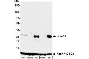 Western Blotting (WB) image for anti-HLA-DR (HLA-DR) antibody (ABIN7449537) (HLA-DR anticorps)