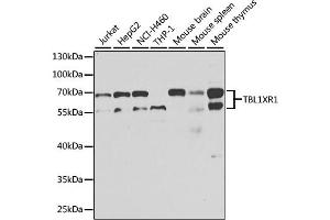 Western blot analysis of extracts of various cell lines, using TBL1XR1 antibody. (TBL1XR1 anticorps)