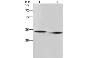 Western Blot analysis of Mouse heart and liver tissue using AMDHD2 Polyclonal Antibody at dilution of 1:500 (AMDHD2 anticorps)
