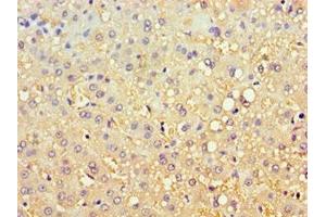 Immunohistochemistry of paraffin-embedded human liver tissue using ABIN7146745 at dilution of 1:100