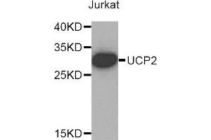 Western blot analysis of extracts of Jurkat cells, using UCP2 antibody. (UCP2 anticorps)