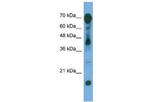 WB Suggested Anti-RAP1GAP Antibody Titration: 0. (RAP1GAP anticorps  (Middle Region))