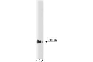 Western Blotting (WB) image for anti-Telomeric Repeat Binding Factor 2, Interacting Protein (TERF2IP) (AA 1-184) antibody (ABIN967815)
