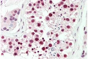 Human Testis: Formalin-Fixed, Paraffin-Embedded (FFPE) (DDX39 anticorps  (AA 229-427))
