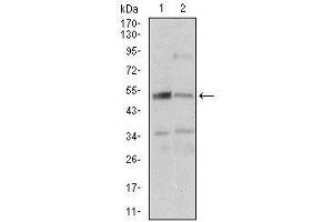 Fig. (DAPK3 anticorps  (AA 28-161))