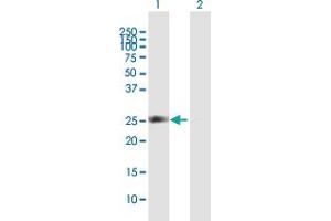 Western Blot analysis of SPR expression in transfected 293T cell line by SPR MaxPab polyclonal antibody.