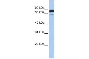 MTMR12 antibody used at 1 ug/ml to detect target protein. (MTMR12 anticorps  (Middle Region))